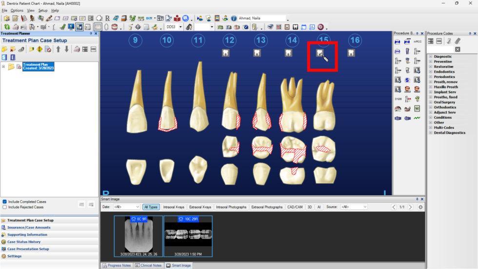 accessing-dentrix-detect-ai-images-from-within-the-patient-chart-the