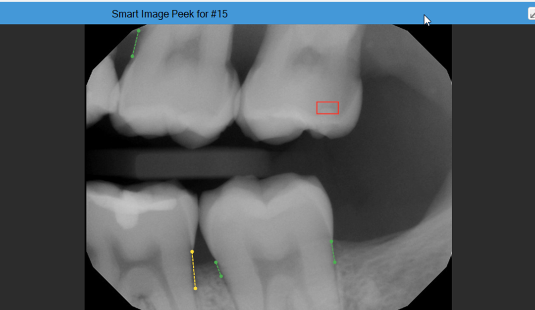 Accessing Dentrix Detect AI Images from Within the Patient Chart